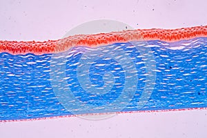 Cornea of Ã¢â¬â¹Ã¢â¬â¹the eye tissue photo